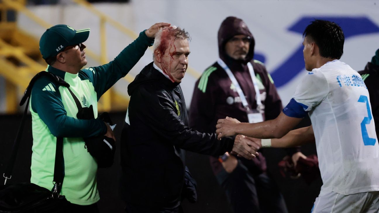 Mexico coach hit in head with beer can in Honduras Mexico coach hit in head with beer can in Honduras